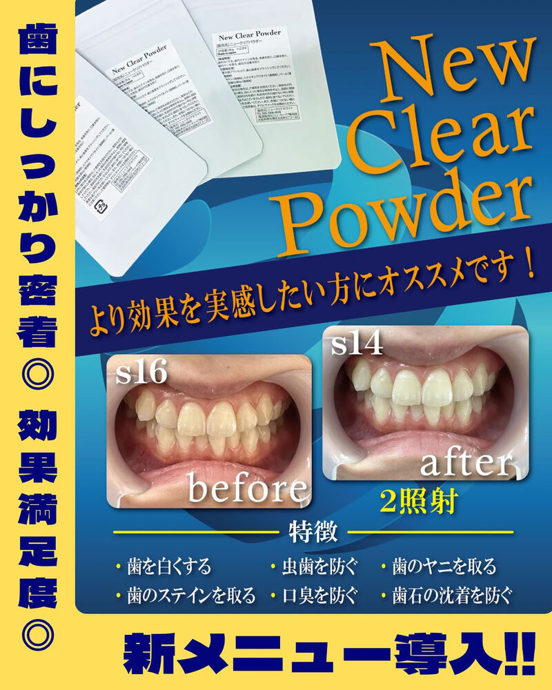 ブログ