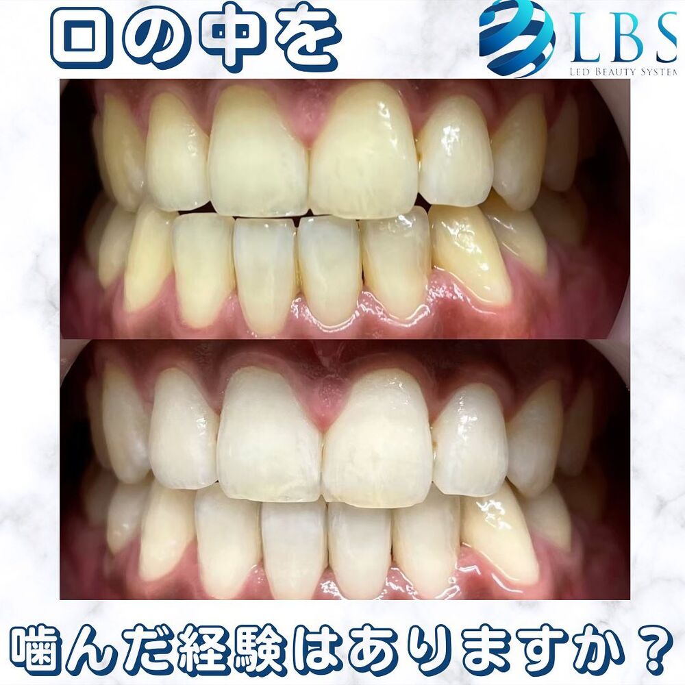ブログ